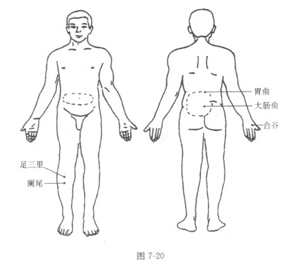 慢性闌尾炎的砭石療法