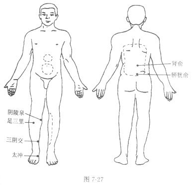 腎結石的砭石療法