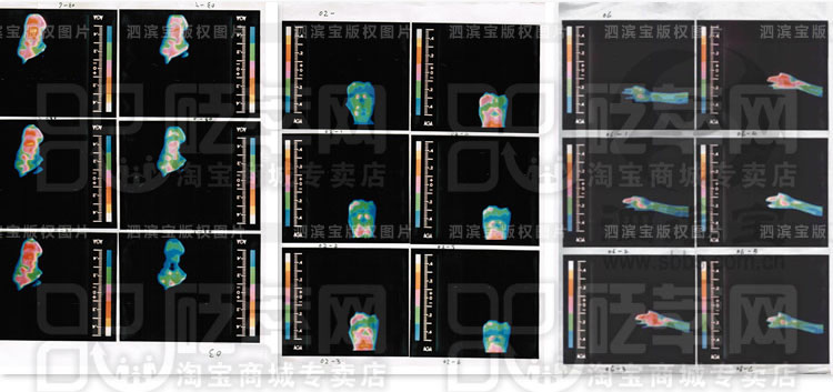 砭石學(xué)堂:泗濱砭石的作用和功效圖8