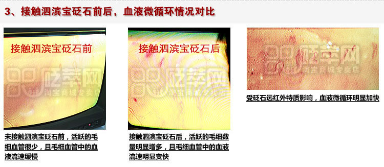 砭石學(xué)堂:泗濱砭石對(duì)人體甲襞微循環(huán)血流速度影響的定量檢測(cè)圖12