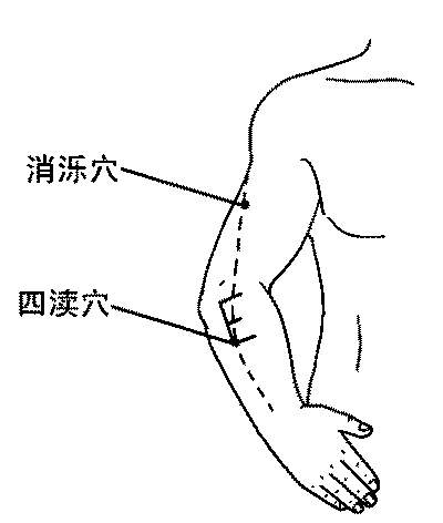 三焦經(jīng)前臂線路
