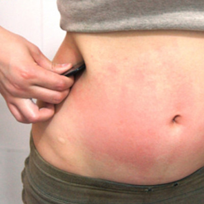 砭石刮痧瘦身圖解、手法及相關(guān)注意事項(xiàng)！