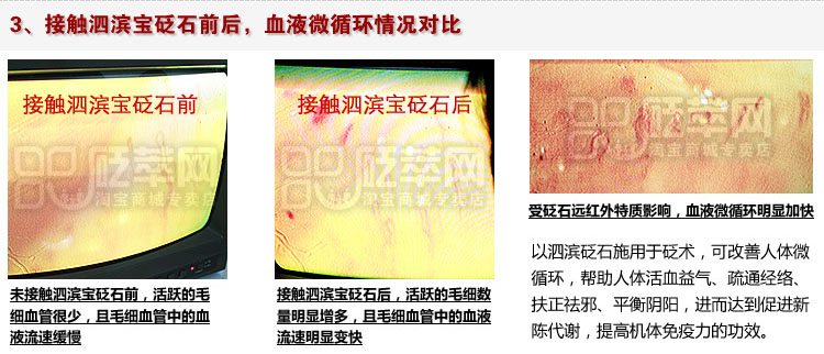 甲襞流微循環(huán)測(cè)試