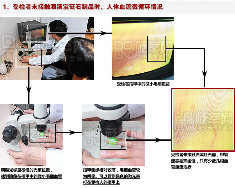 甲襞流微循環(huán)測(cè)試